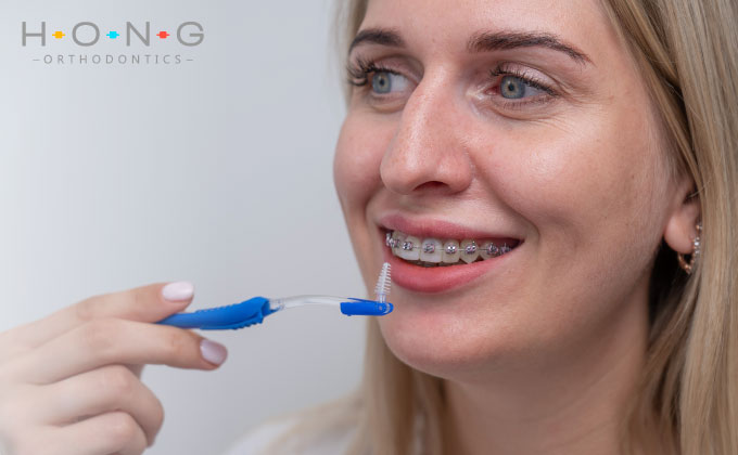 Dental hygiene is critical during orthodontics. Do everything you can to maintain a good routine.